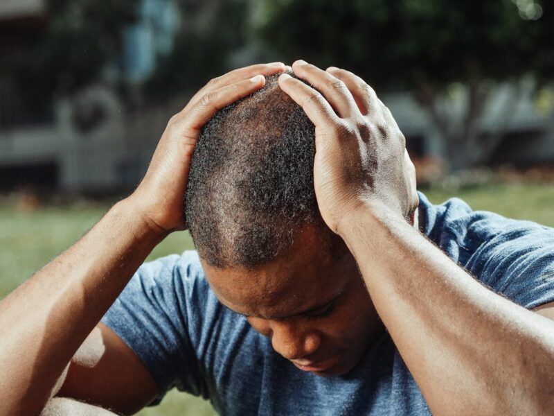 Best Hair Fibers for Concealing Thinning